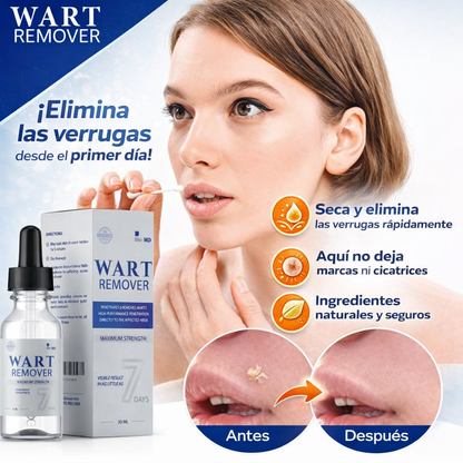 Dermalux Perú™ Serum para las Verrugas