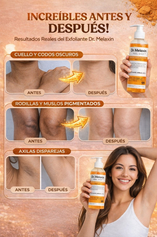 Spray exfoliante™ - Skin lightener