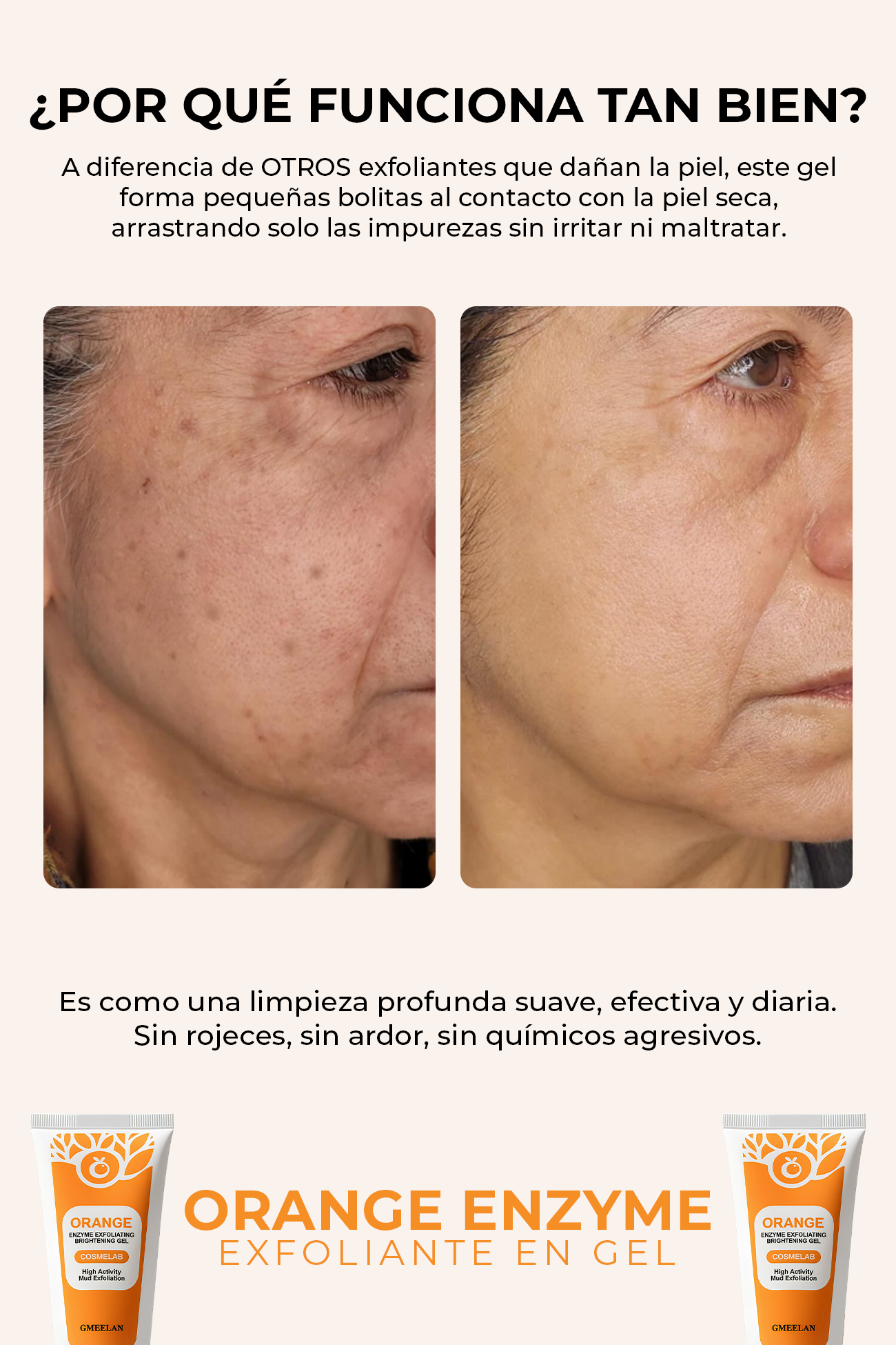 Gel exfoliante ™ Skin lightener