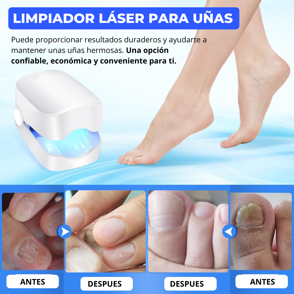 Limpiador laser para uñas ™ Laser Nail