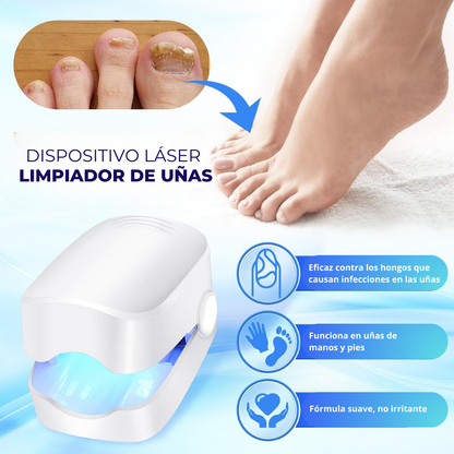 Limpiador laser para uñas ™ Laser Nail