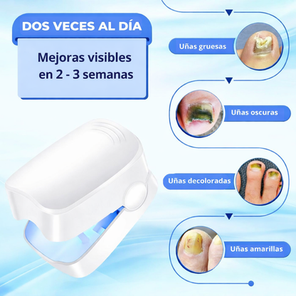 Limpiador laser para uñas ™ Laser Nail